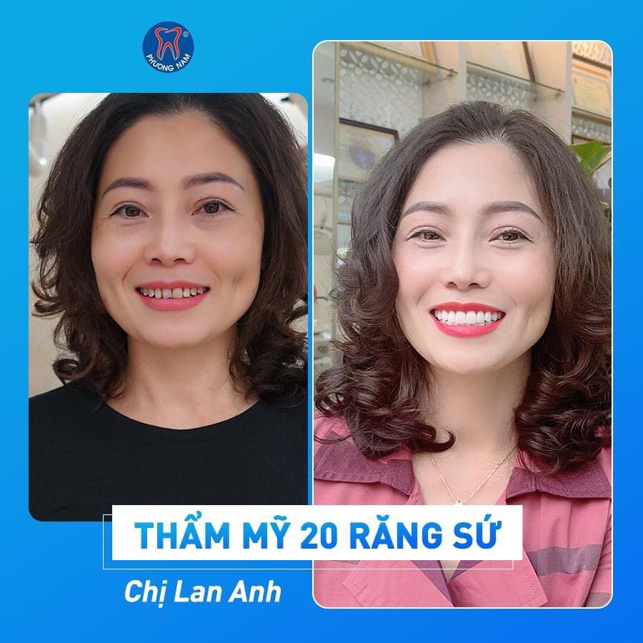 Nha Khoa Phương Nam - Chi nhánh Tuyên Quang ảnh 2