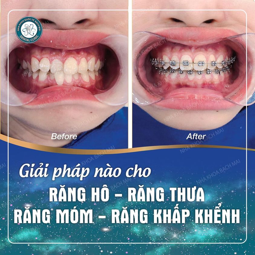 Nha Khoa Quốc Tế Bạch Mai ảnh 1