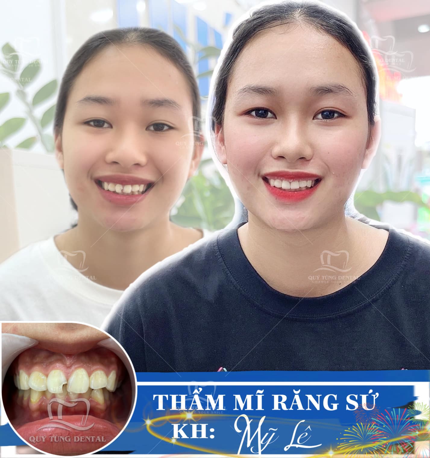 Nha Khoa Quý Tùng Thái Nguyên ảnh 1