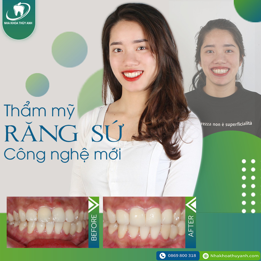 Nha Khoa Thùy Anh ảnh 1