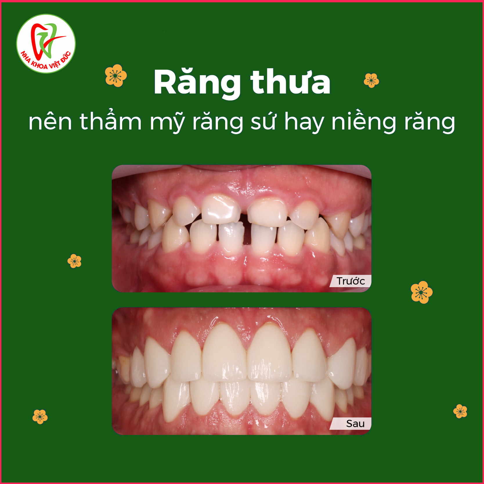 Nha Khoa Việt Đức ảnh 1