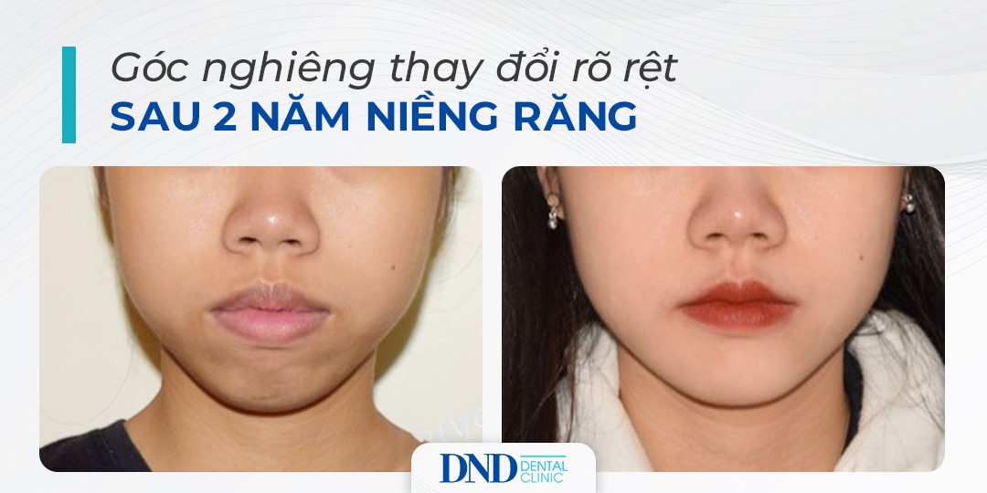 Nha khoa Quốc tế DND ảnh 2