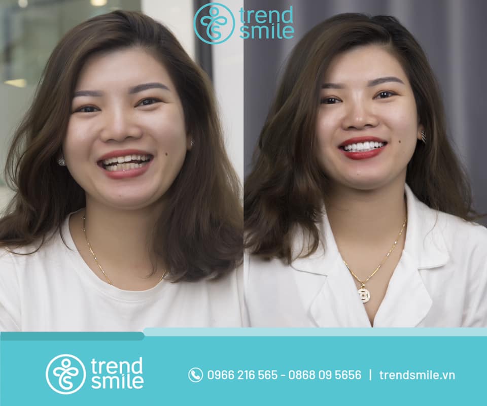 Nha khoa Thẩm mỹ Quốc tế Trend Smile ảnh 1