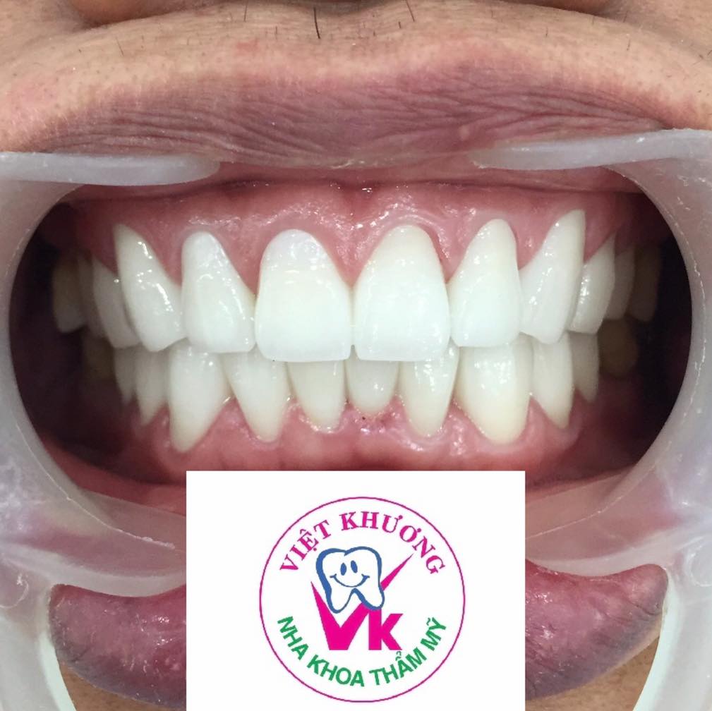 Nha khoa Việt Khương ảnh 1