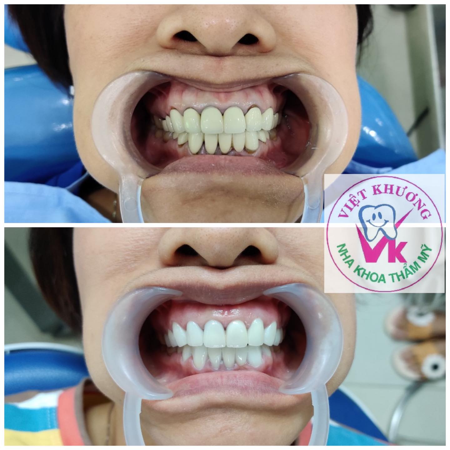 Nha khoa Việt Khương ảnh 2