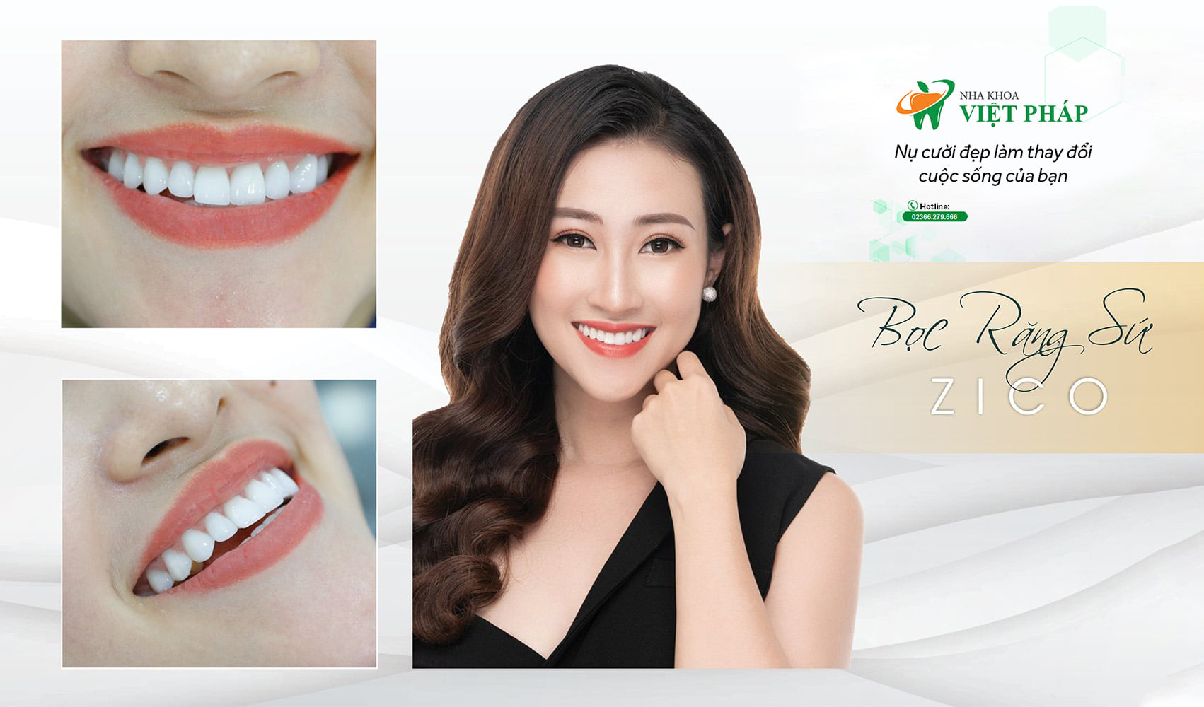 Nha khoa Việt Pháp ảnh 1