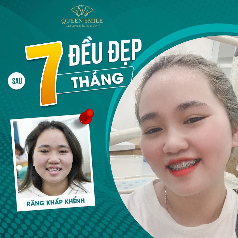 Nha khoa thẩm mỹ Queen Smile ảnh 1