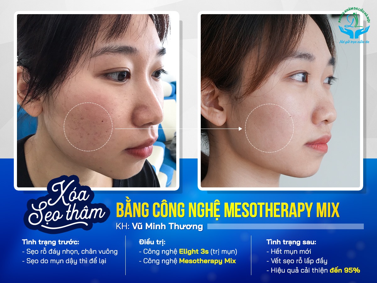 Phòng Khám Da Liễu Hà Nội ảnh 1