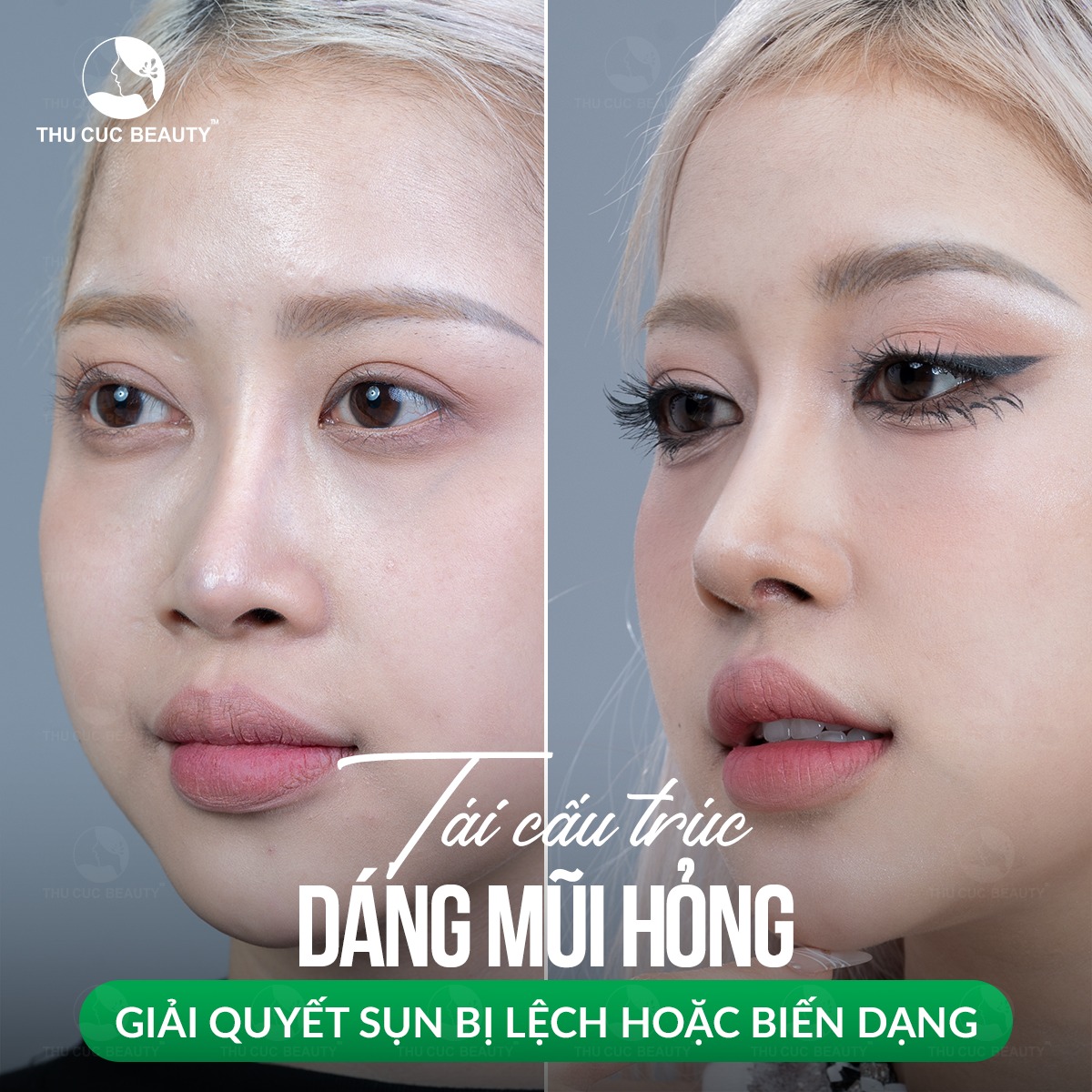 Bệnh viện thẩm mỹ Thu Cúc ảnh 1