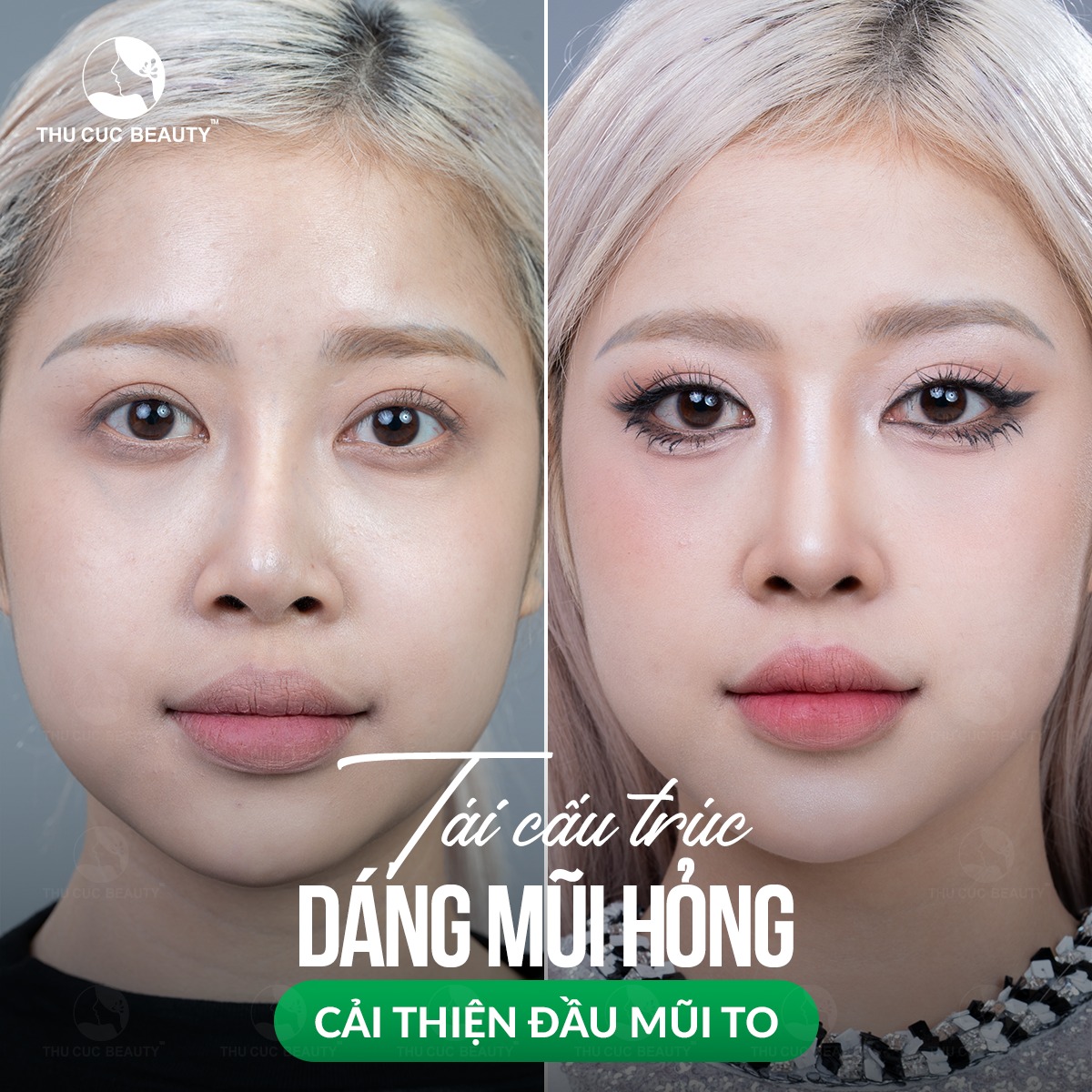 Bệnh viện thẩm mỹ Thu Cúc ảnh 2