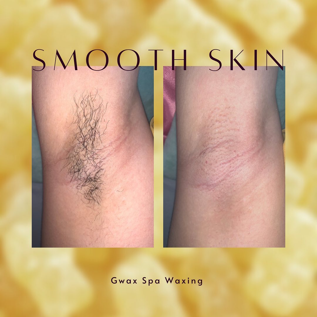 Gwax Spa Waxing ảnh 2