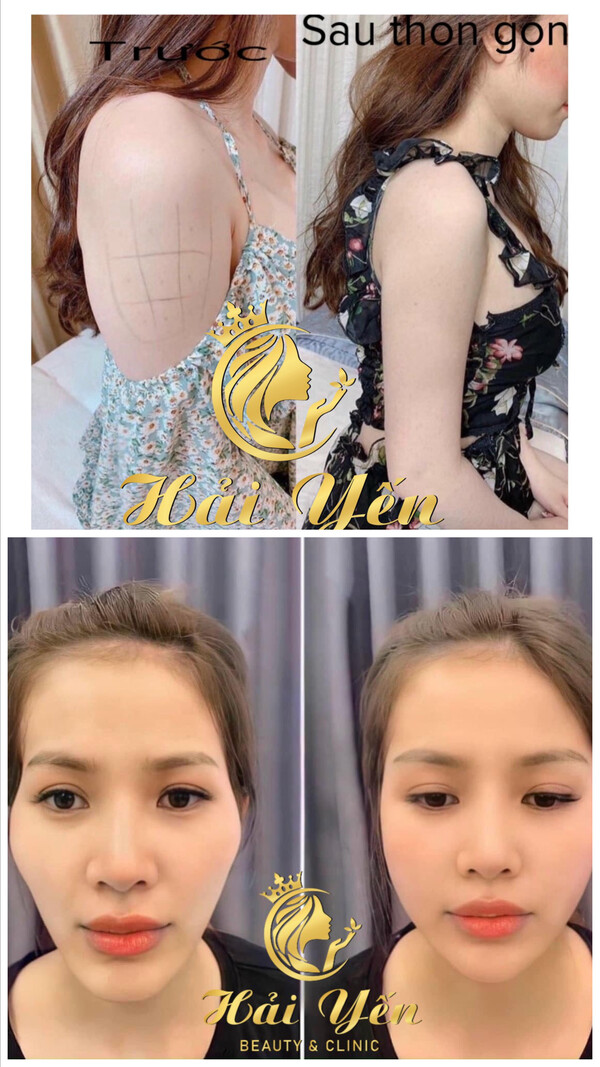 Hải Yến Beauty Clinic ảnh 2