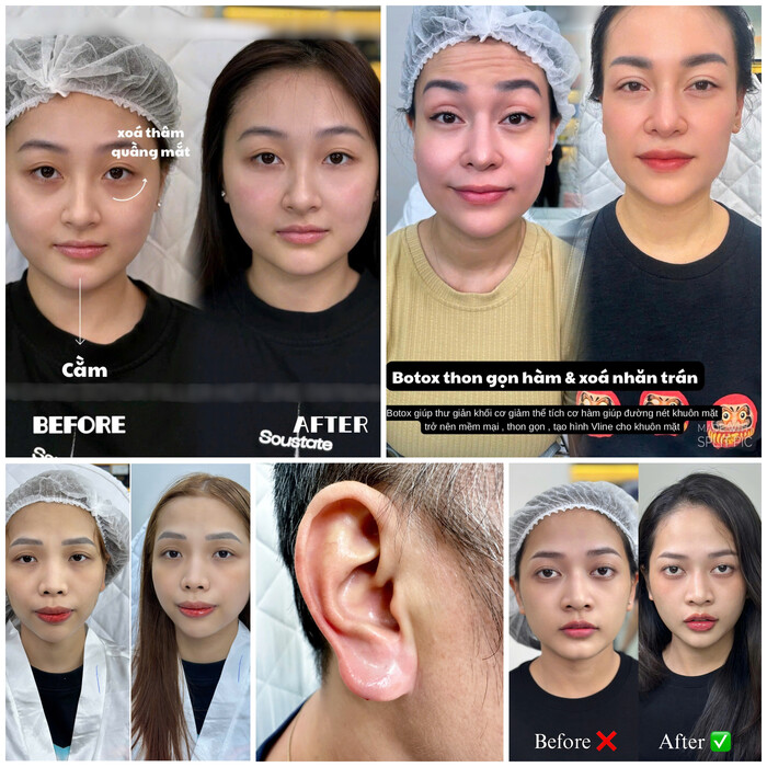 Hải Yến Beauty Clinic ảnh 3