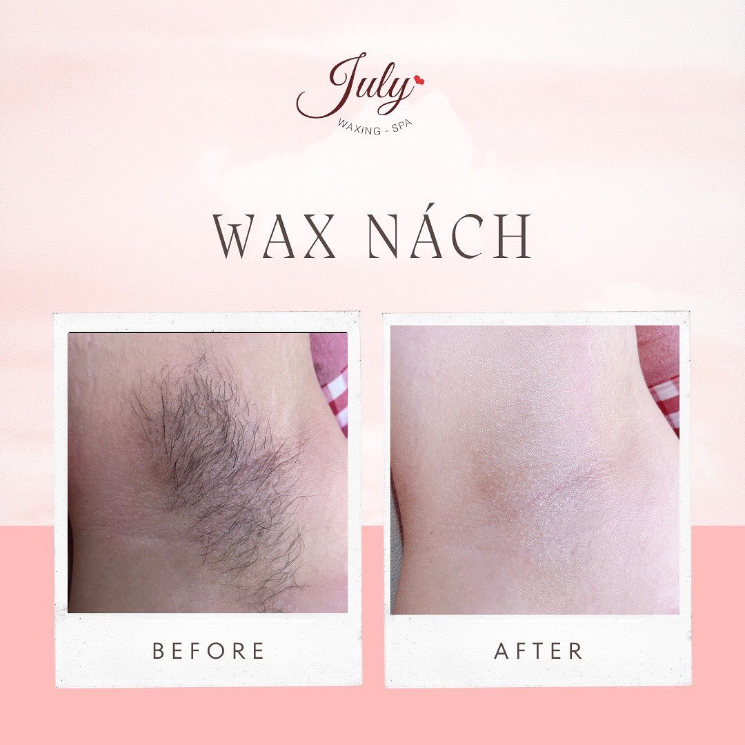 July.Waxing-Spa ảnh 1