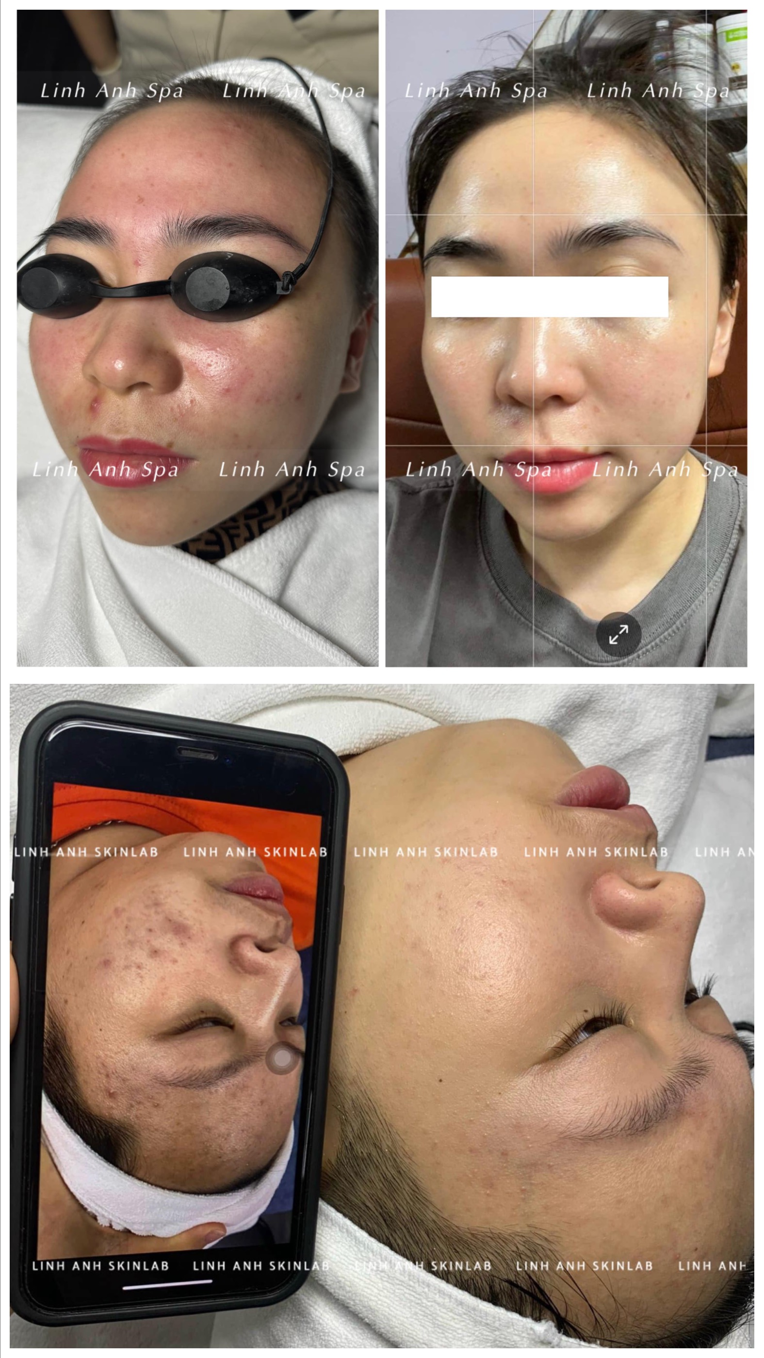 Linh Anh Skinlab ảnh 2