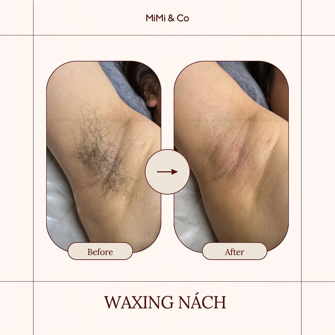 MiMi & Co Waxing ảnh 1