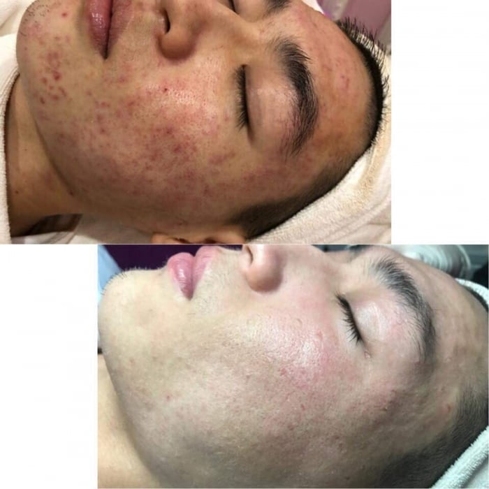 Nàng Spa ảnh 1