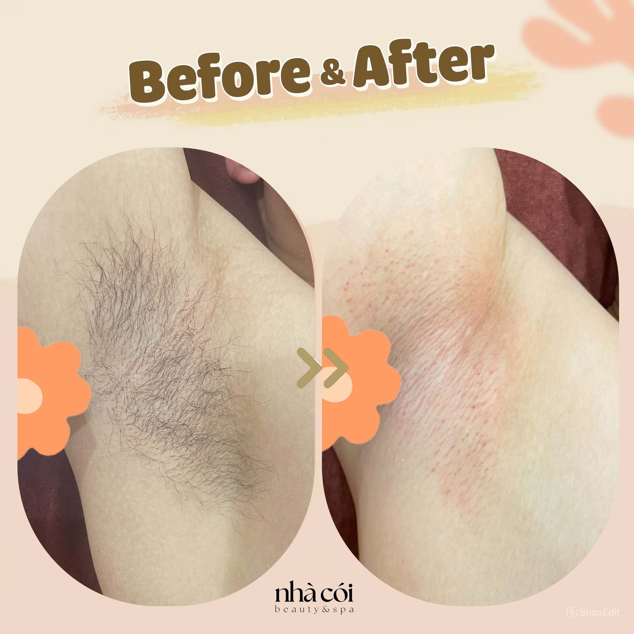 Nhà Cói Waxing ảnh 1