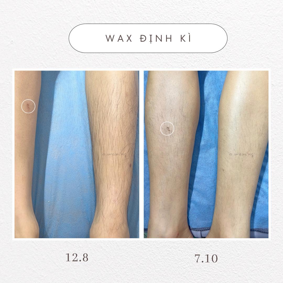 S.waxing ảnh 1