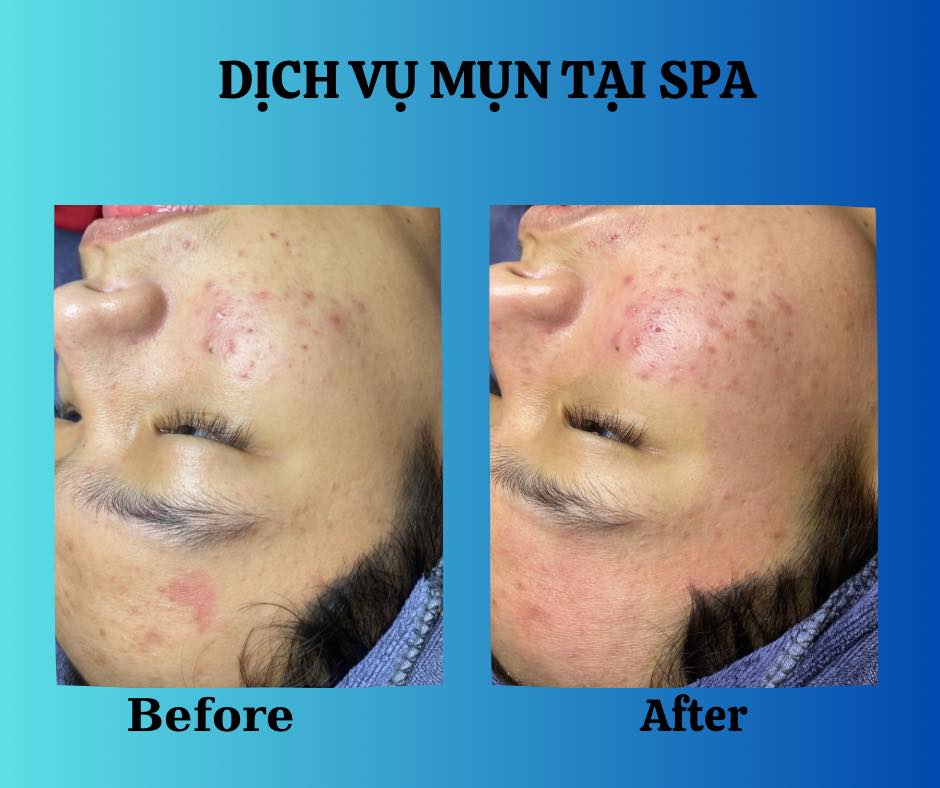 Spa Kiều Diễm ảnh 2