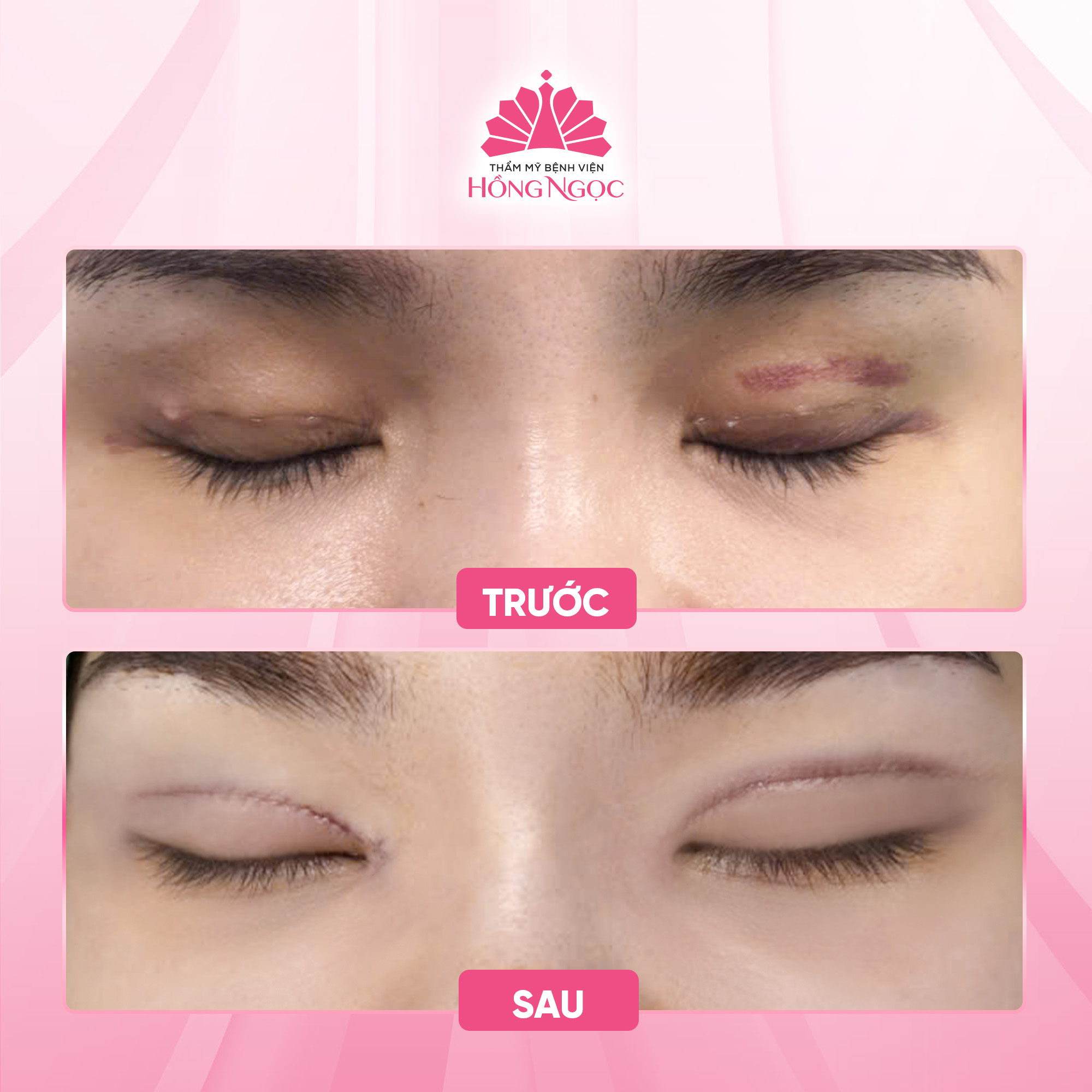Thẩm Mỹ Bệnh Viện Hồng Ngọc ảnh 1