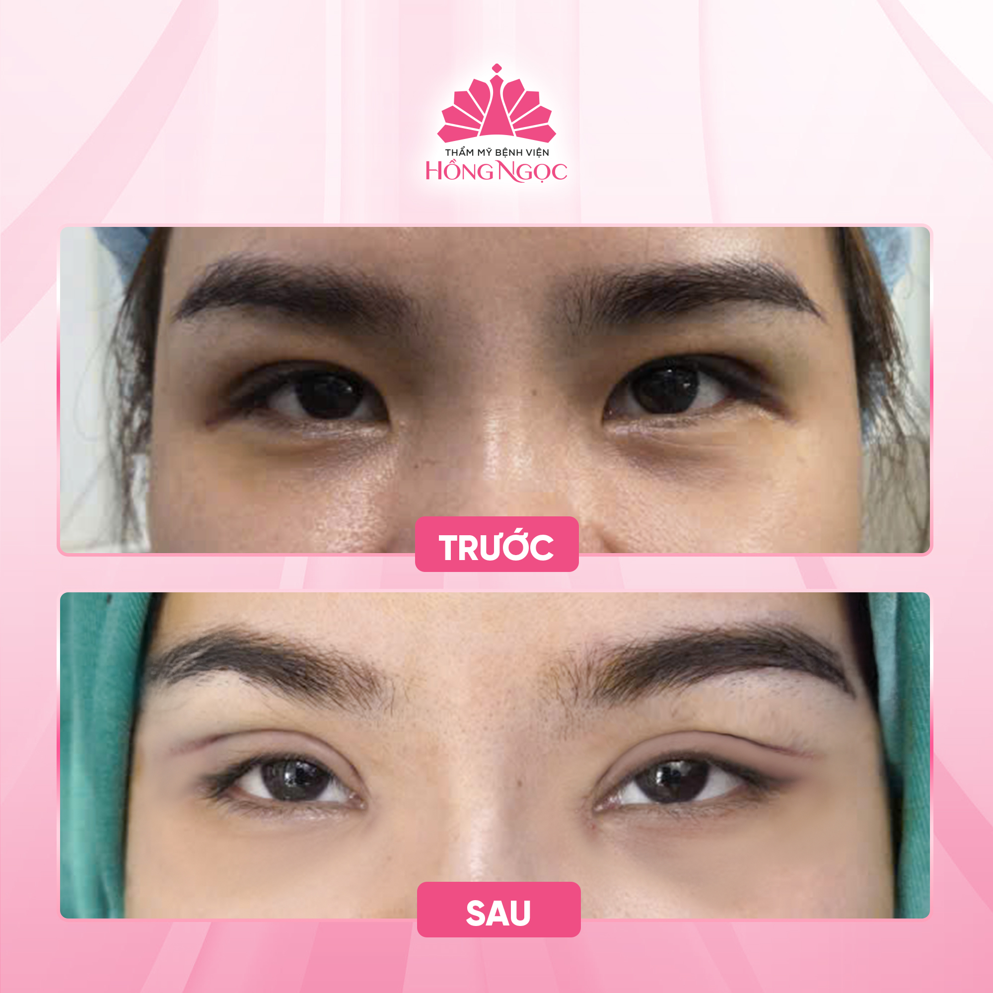 Thẩm Mỹ Bệnh Viện Hồng Ngọc ảnh 2