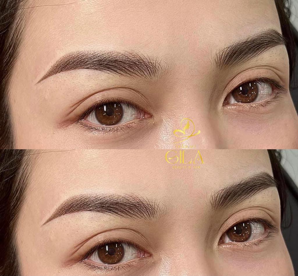 Thẩm Mỹ GiLa - Beauty & Spa ảnh 1