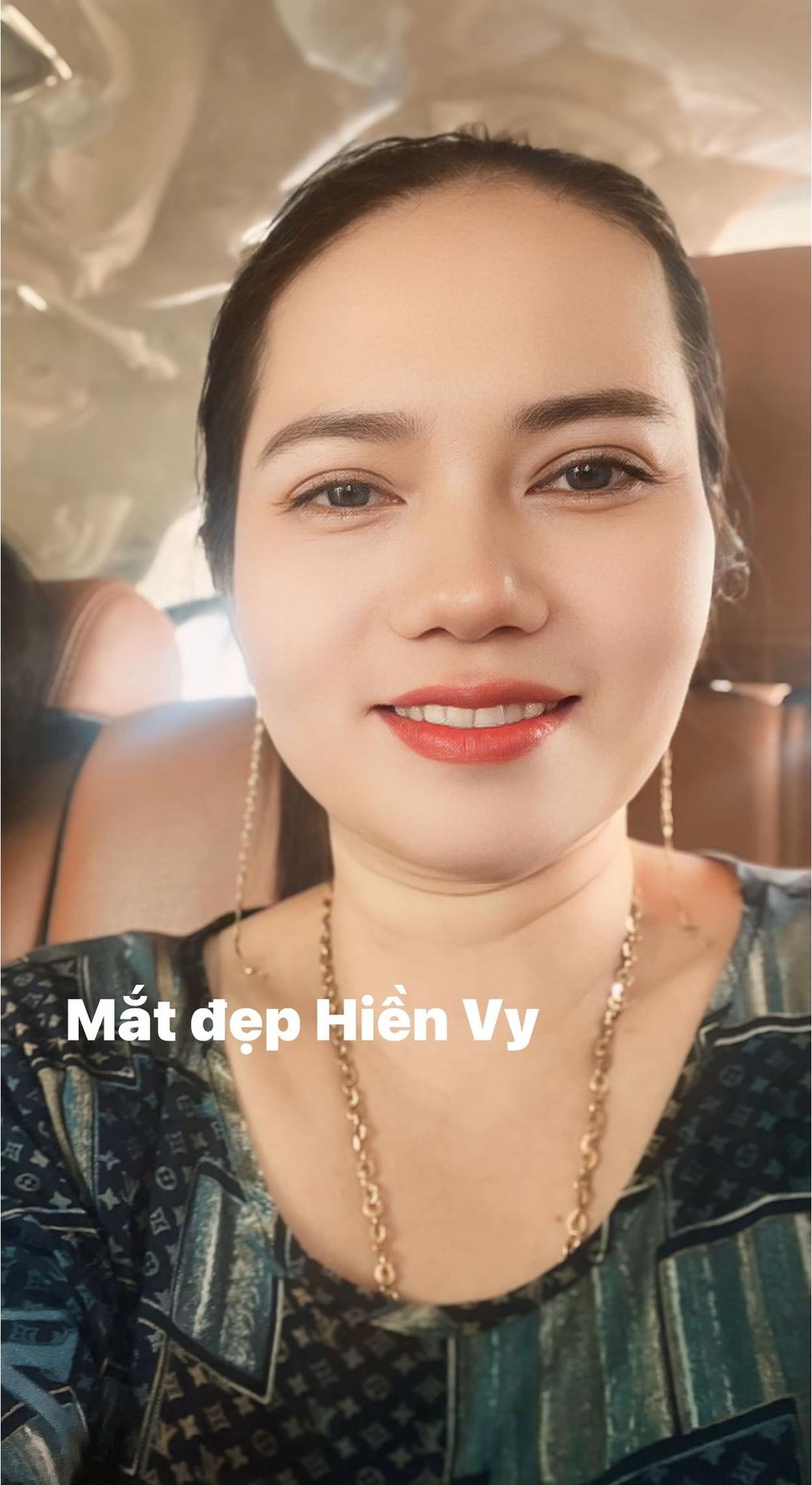 Thẩm Mỹ Hiền Vy ảnh 1