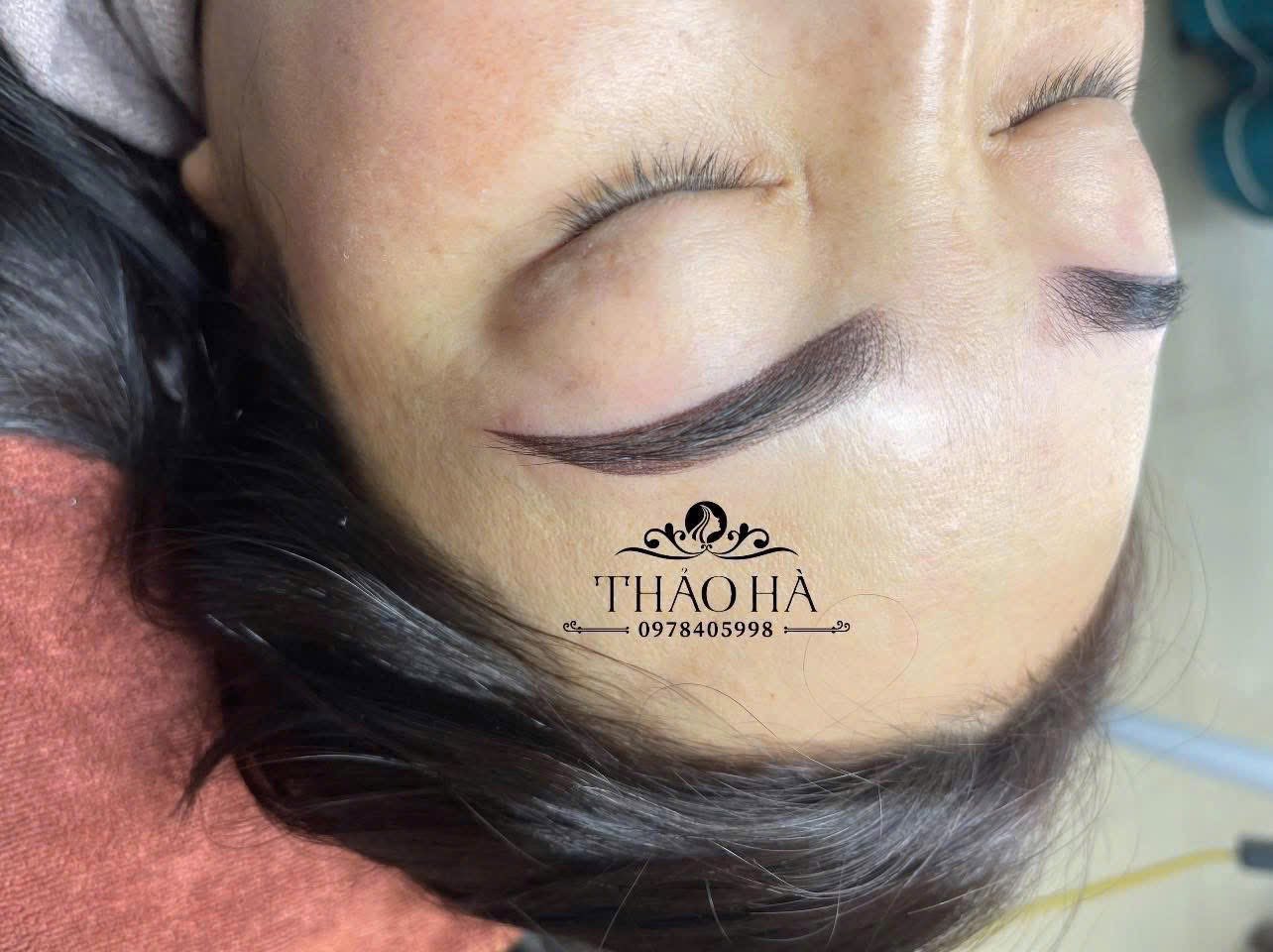 Thẩm Mỹ Thảo Hà ảnh 2