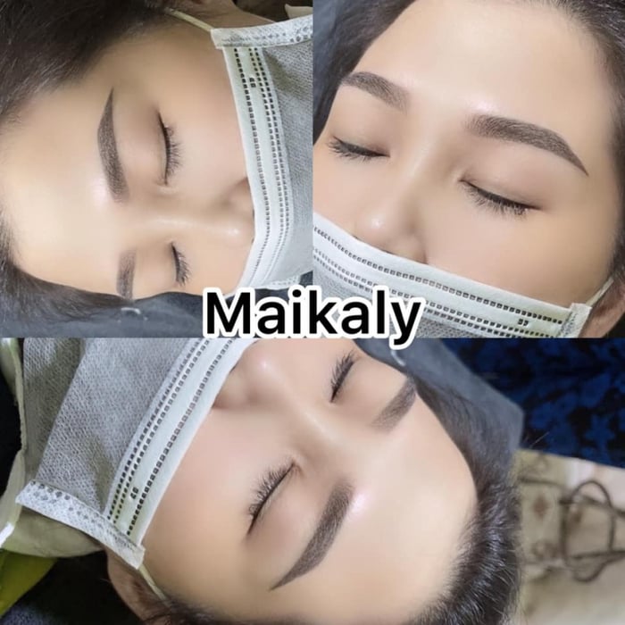 Thẩm mỹ Maika Ly ảnh 1