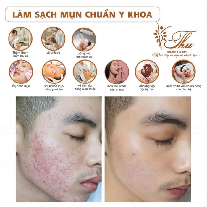 Thu Spa ảnh 1