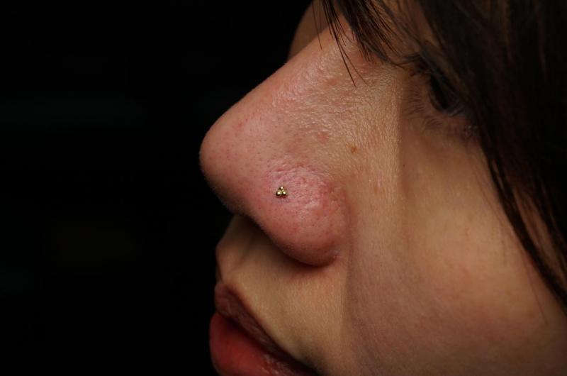 Vịt Xỏ Khuyên ảnh 2