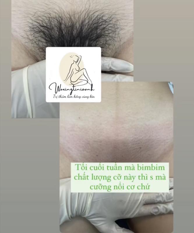 Waxing.tinioanh ảnh 1