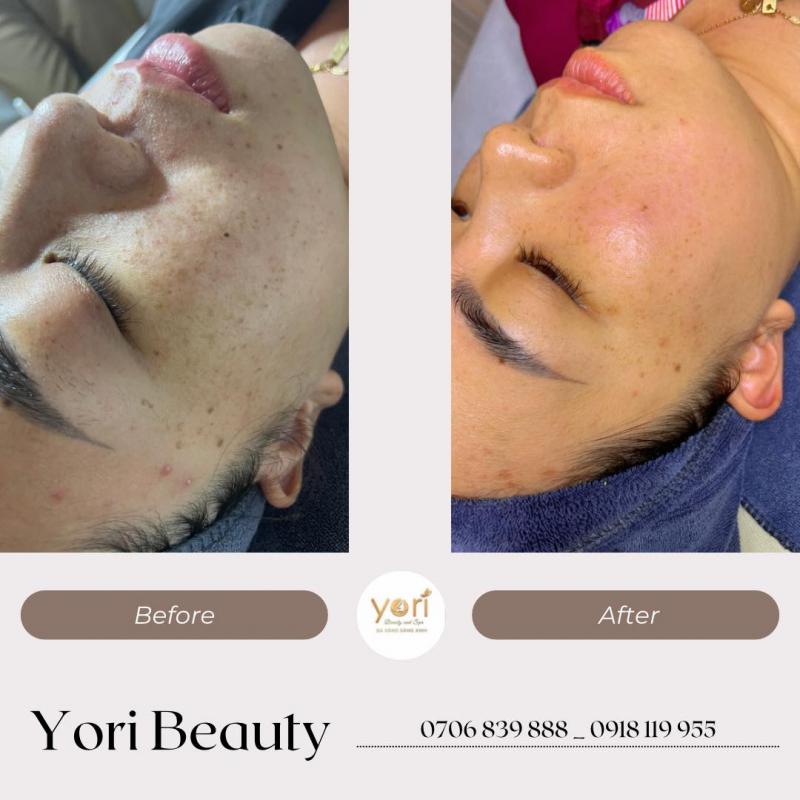 Yori Beauty & Spa ảnh 1