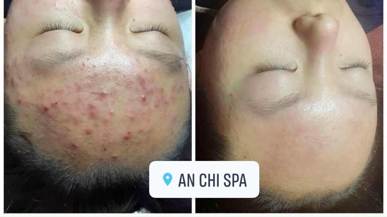 An Chi Spa ảnh 1