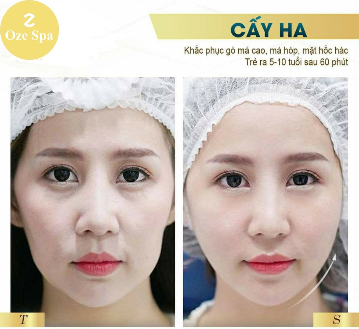 Oze Spa ảnh 2