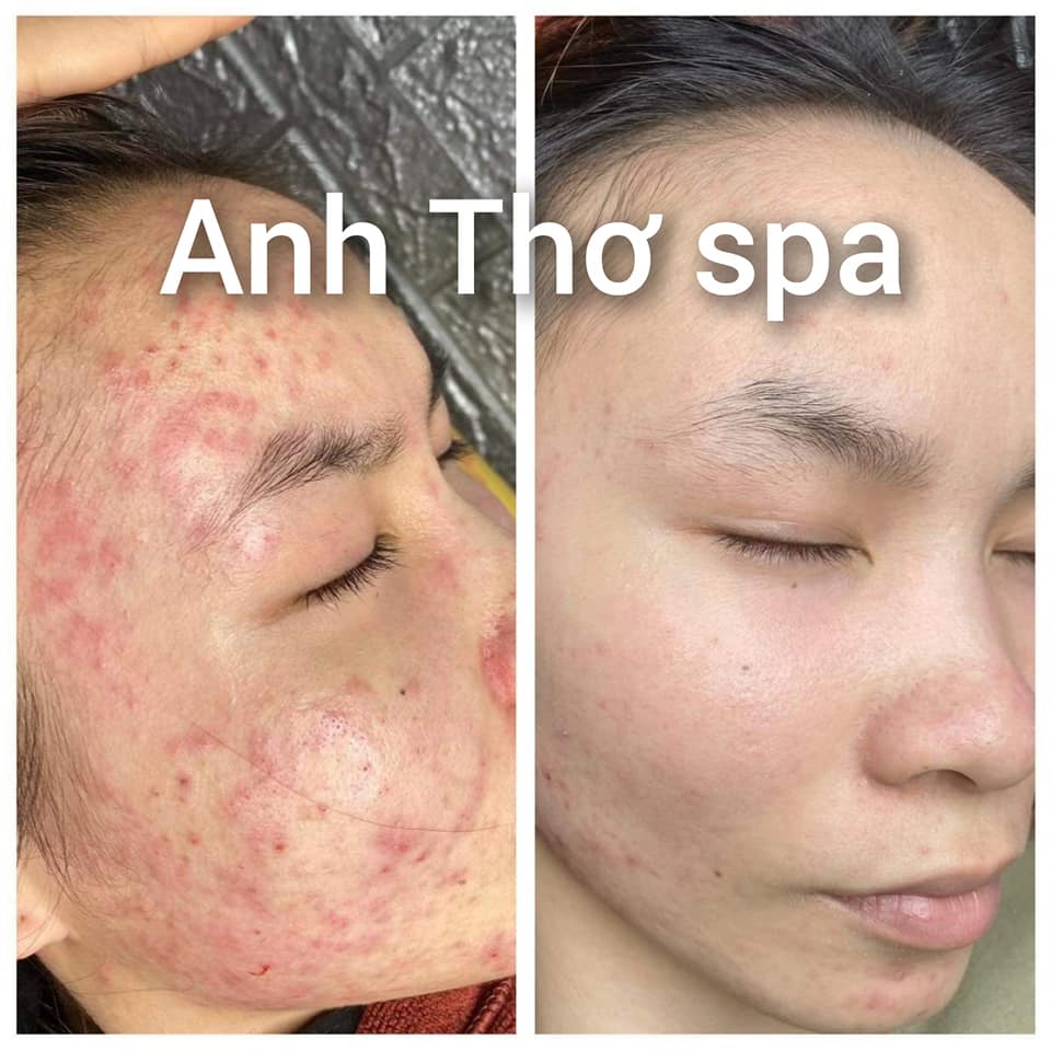 Anh Thơ Spa ảnh 1