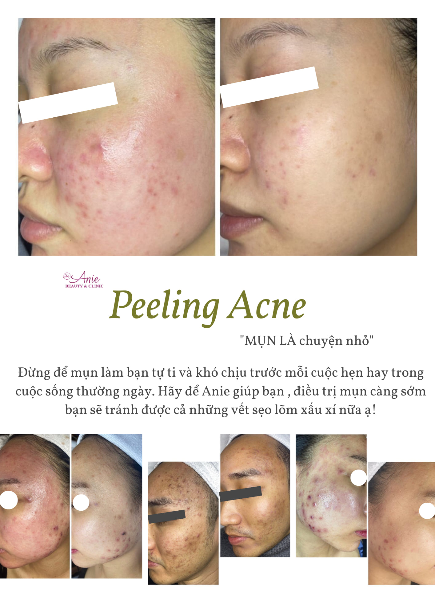 Anie Beauty & Clinic Bắc Giang ảnh 2