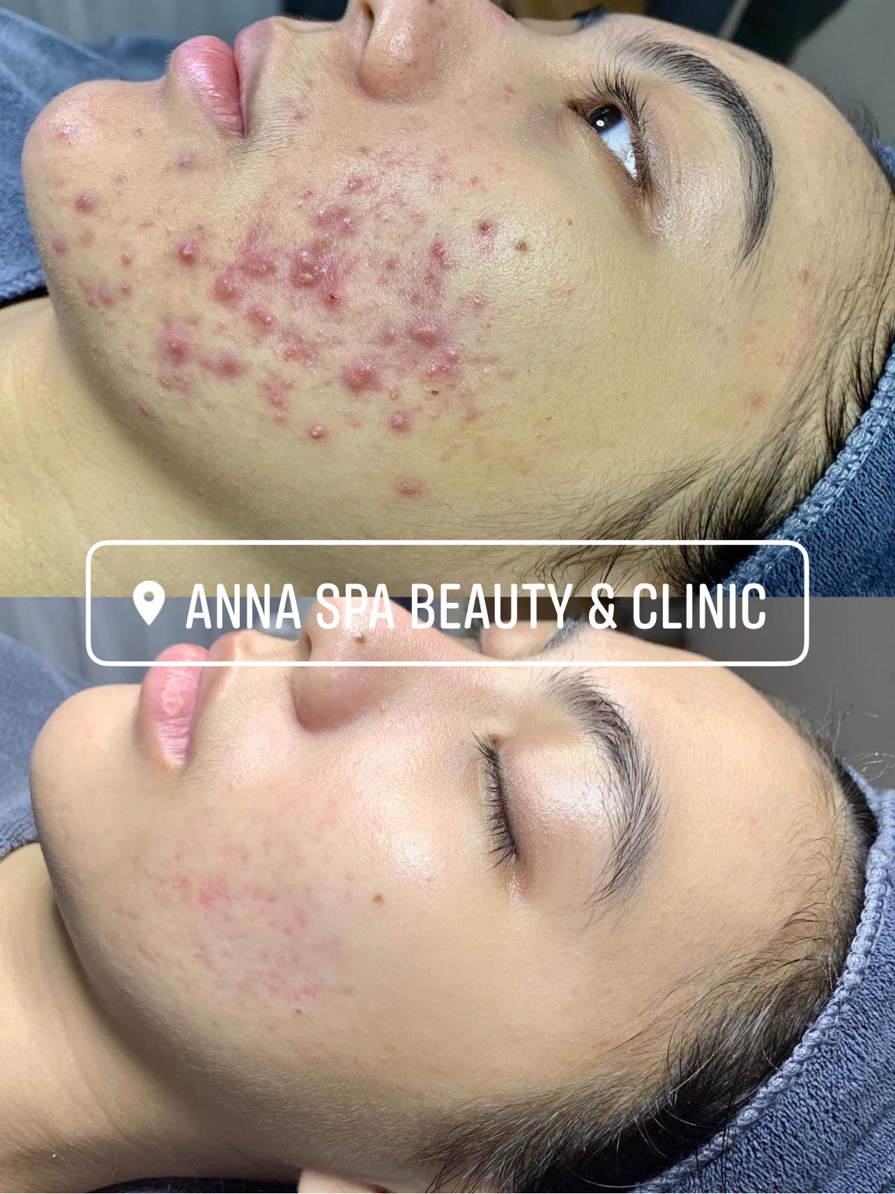 Anna Spa ảnh 1