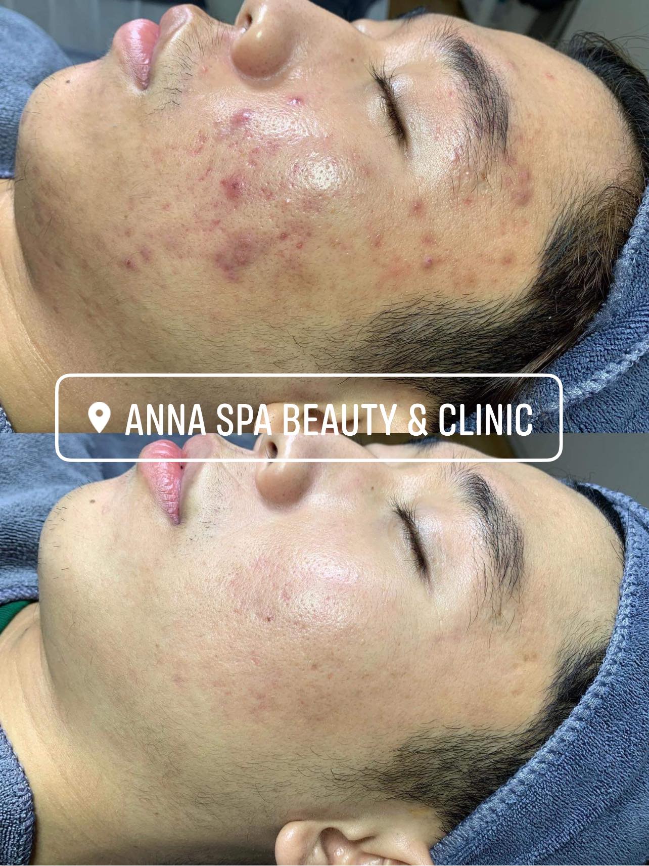 Anna Spa ảnh 2