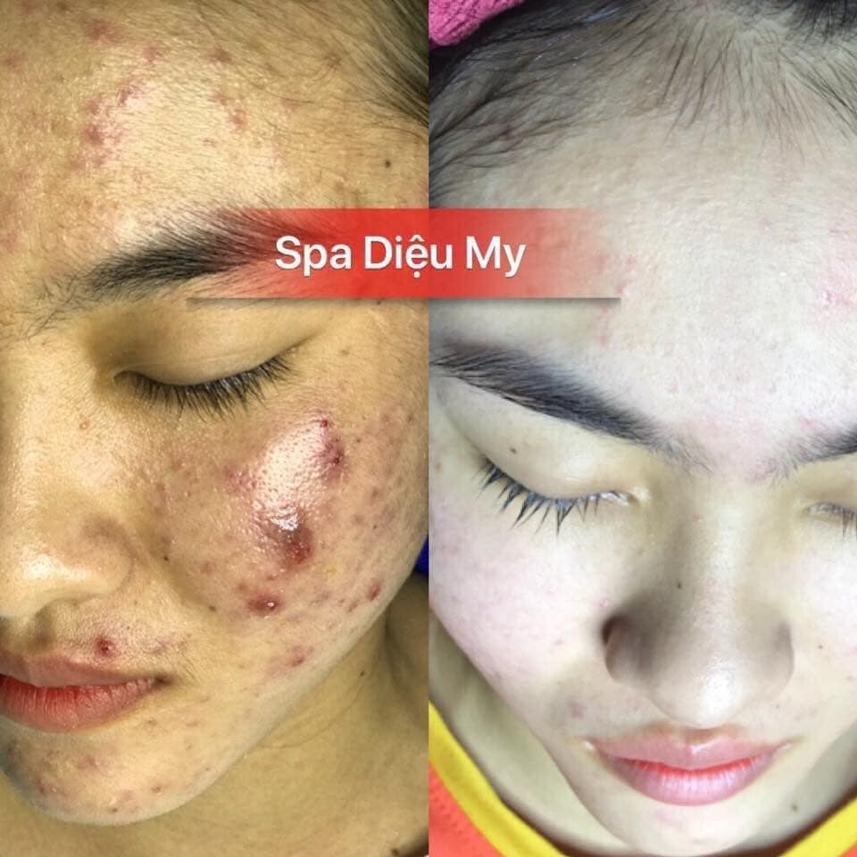 Diệu My Spa ảnh 2