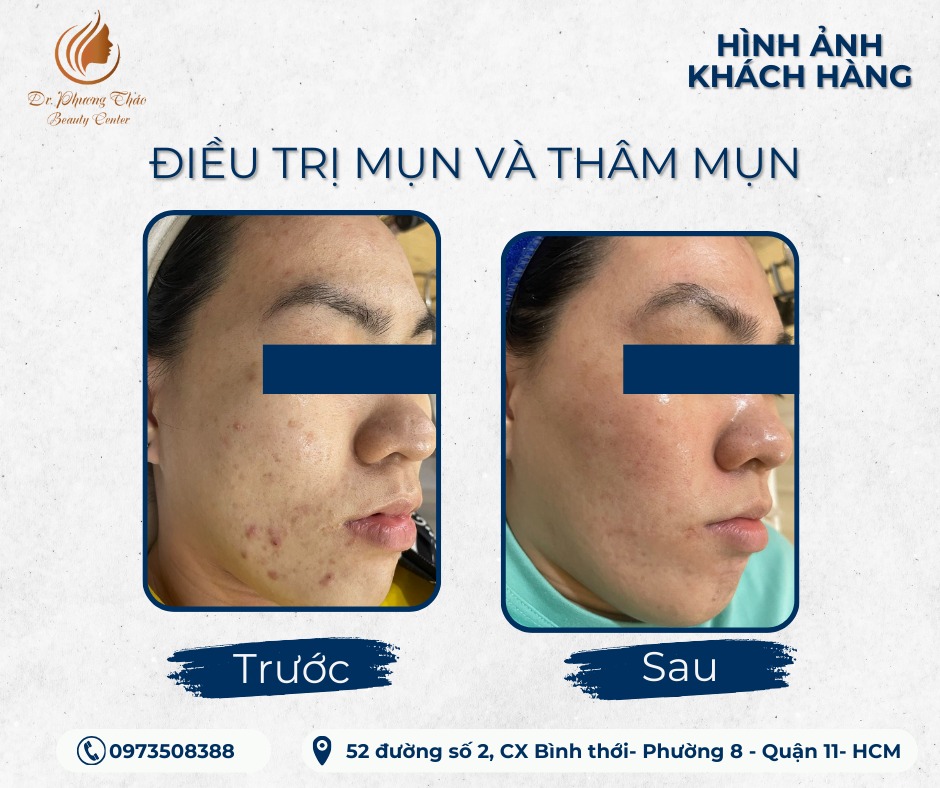 Dr.PhuongThao Beauty Center ảnh 2