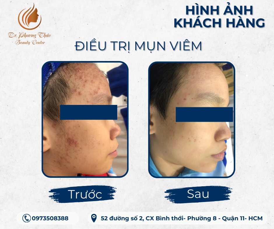 Dr.PhuongThao Beauty Center ảnh 1