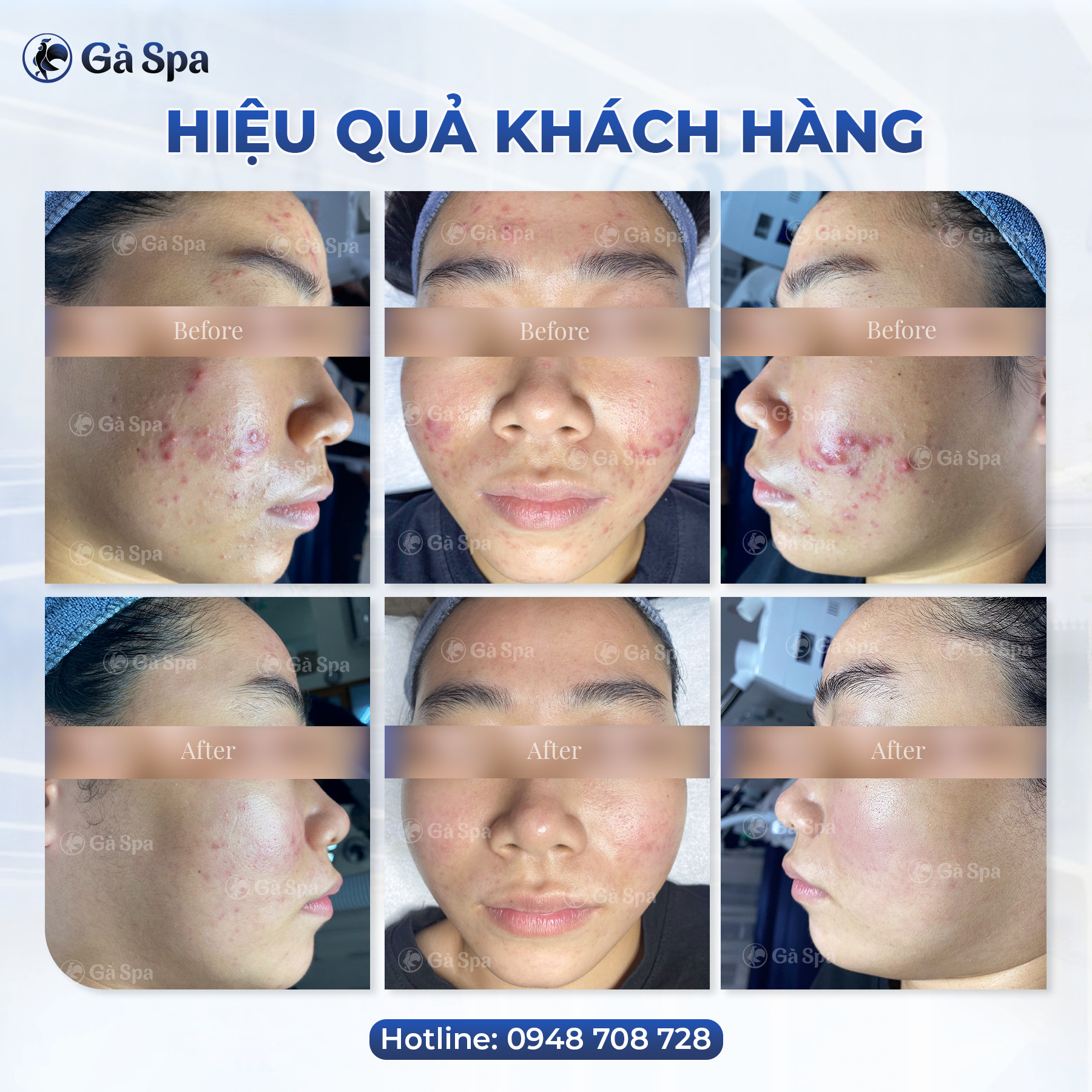 Gà Spa Long An ảnh 1