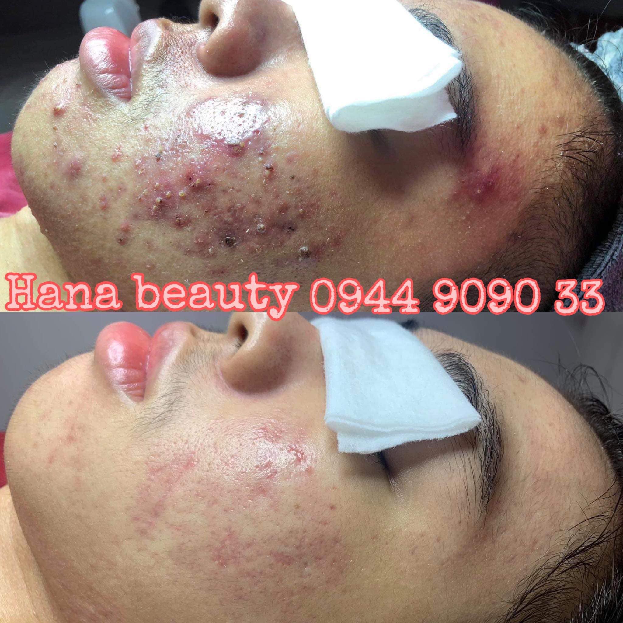 HANA Beauty Spa & Cosmetic ảnh 3