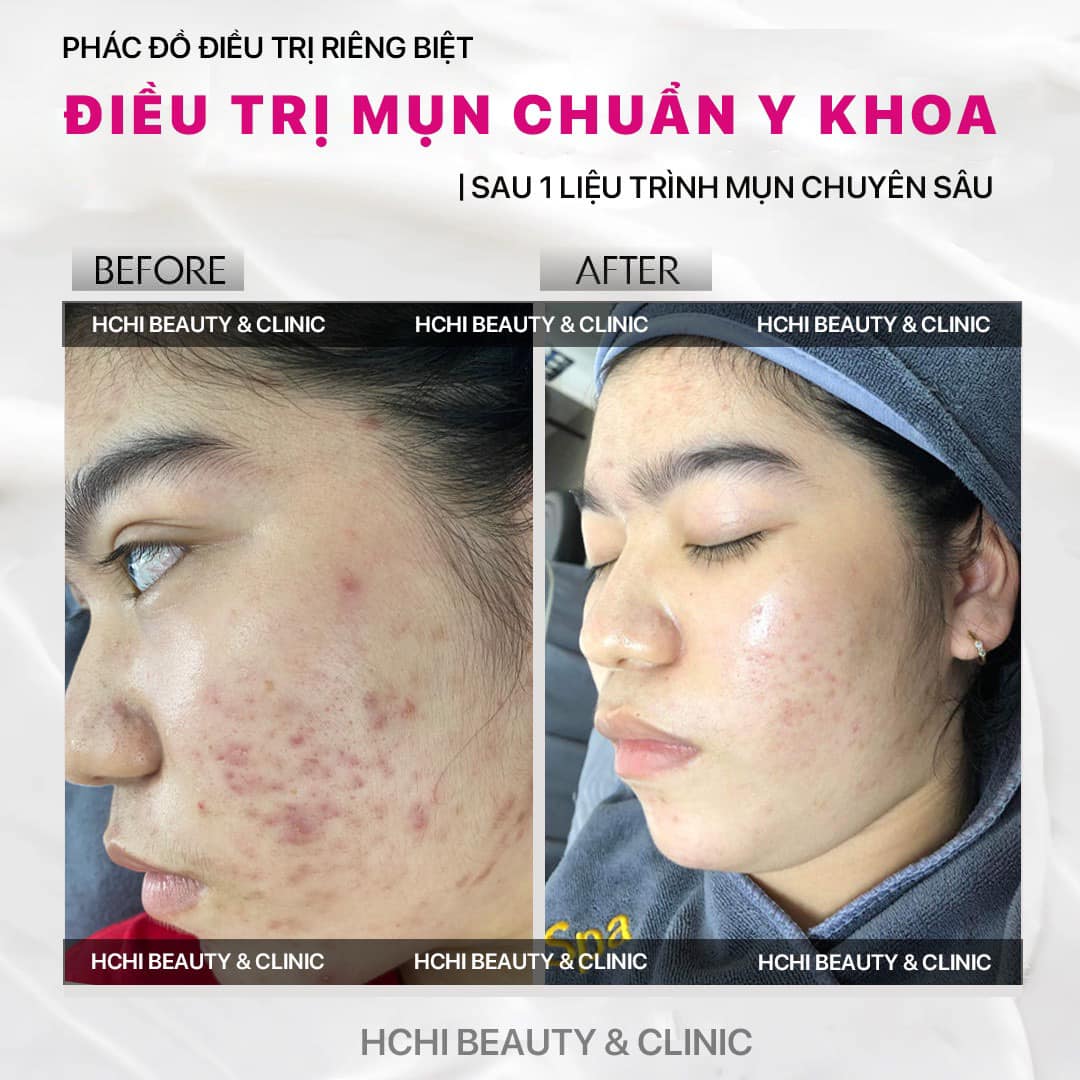 HCHI Beauty Clinic ảnh 1