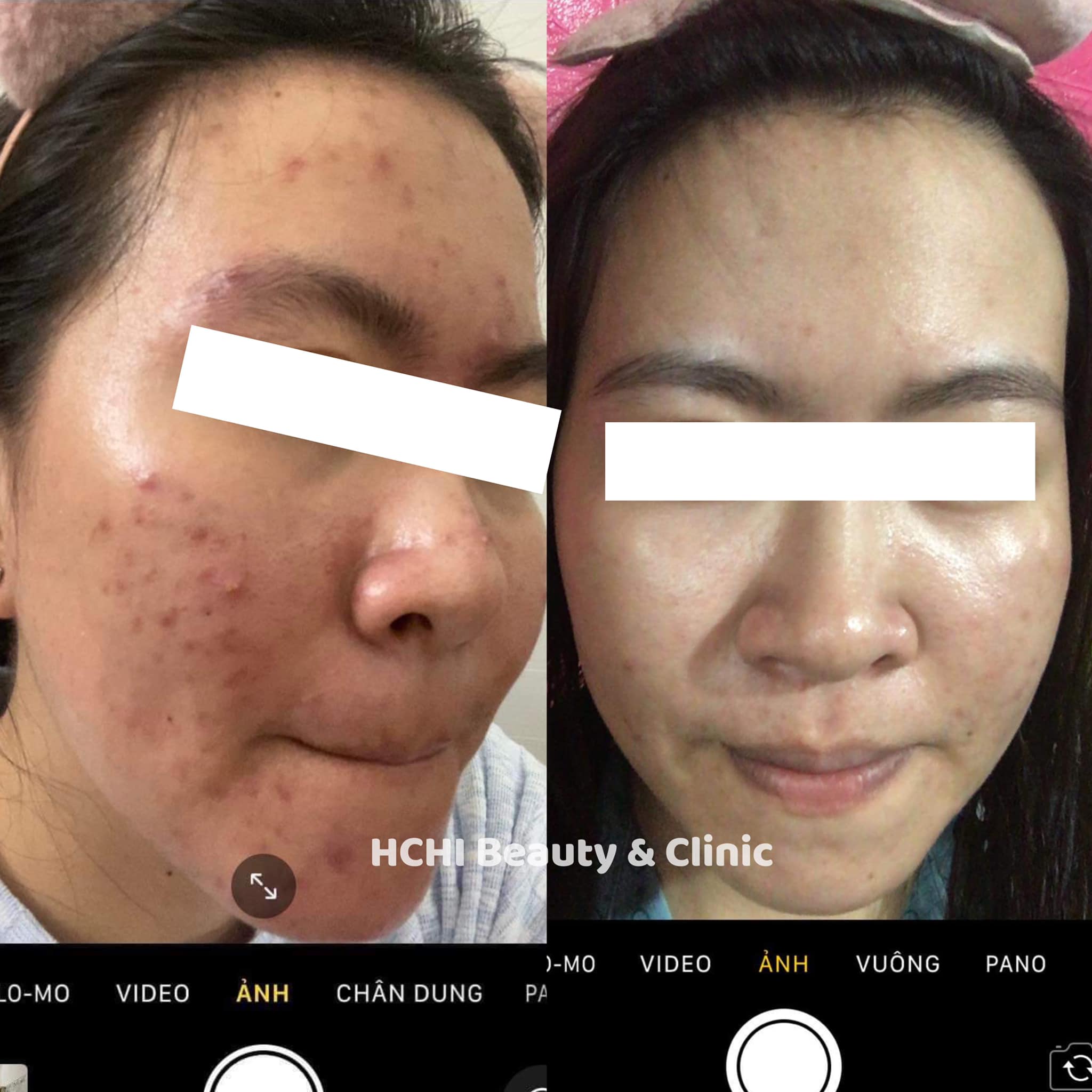 HCHI Beauty Clinic ảnh 2