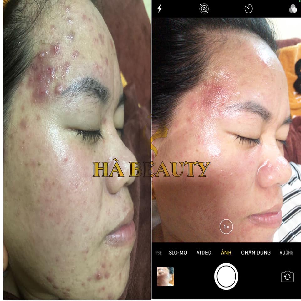 Hà Beauty Spa (Lại Cẩm Hà) ảnh 1