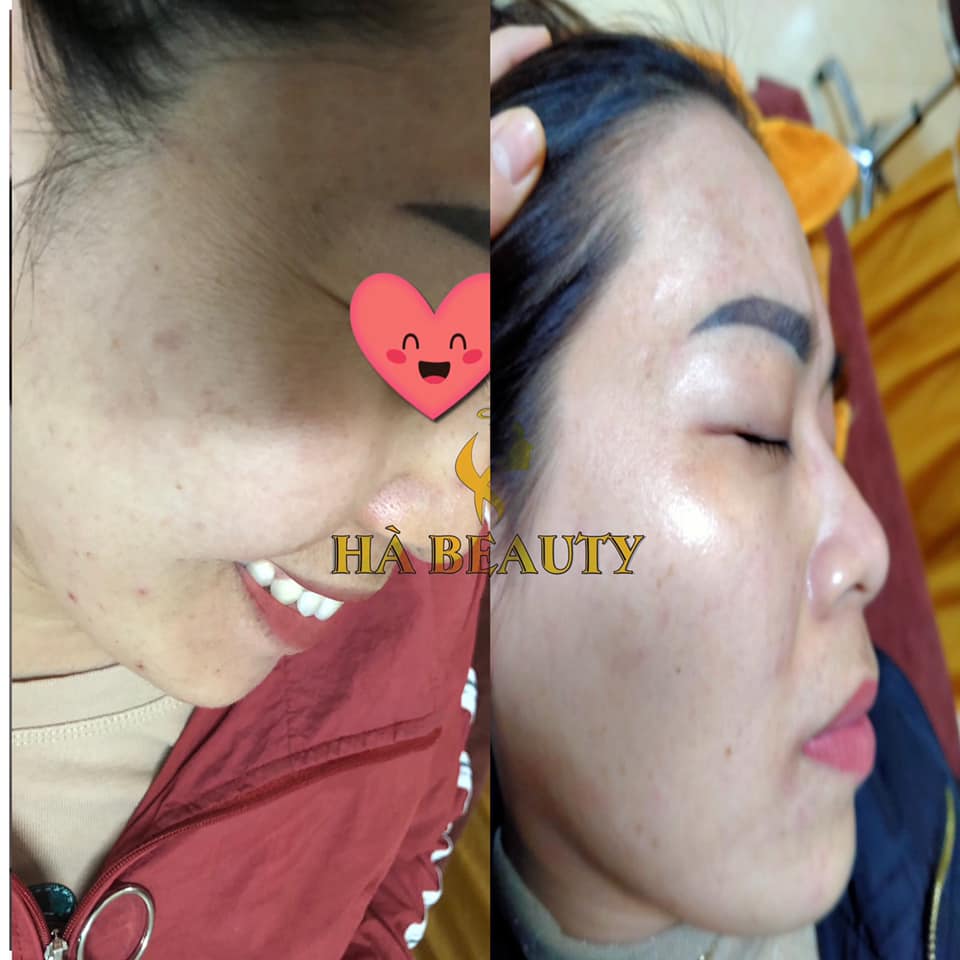 Hà Beauty Spa (Lại Cẩm Hà) ảnh 2