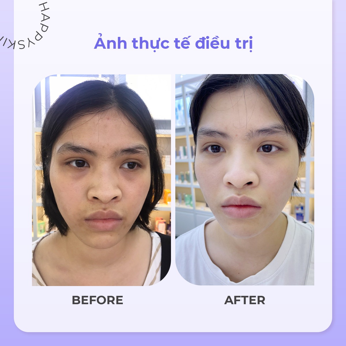 Happy Skin Beauty Clinic ảnh 2